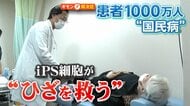 iPS細胞が1000万人の“ひざを救う”？“世界初”人工軟骨の新技術「4年後に実用化へ」…安全面・生産コストが課題