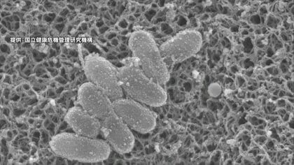 【速報】百日咳の感染者数が6週ぶりに減少し3399人になるも依然高い水準続く