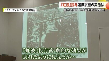 「人間扱いとは思えない」開発途中の薬剤『虹波』をハンセン病患者に投与した臨床試験の実態は【熊本】