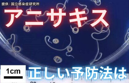 【注意】サバ・イカ・アジも…「アニサキス」食中毒はなぜ起きる？正しい予防法を専門家に聞いた