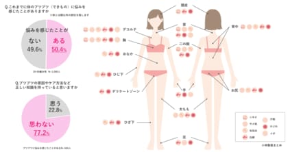 それってニキビじゃないかも?“ からだの部位 ”や“ ブツブツの種類 ”ごとに正しいケアへと導く、皮膚科医監修「からだのブツブツまるわかりMAP」を公開!