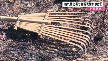 枯れ草火災で高齢男性がやけど　「燃やしていたら燃え広がった」【熊本】