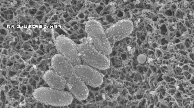【速報】百日咳の感染者数が6週ぶりに減少し3399人になるも依然高い水準続く｜FNNプライムオンライン