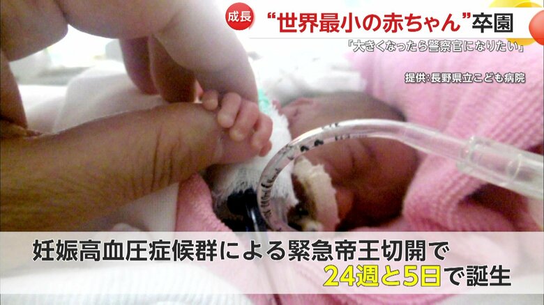 「妊娠高血圧症候群」による緊急帝王切開で、妊娠24週と5日で生まれた竜佑ちゃん