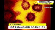 新型コロナ 県内で新たに113人の感染確認