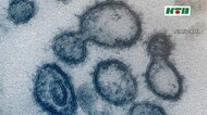 【速報】新型コロナ 長崎県内で新たに10人の感染発表