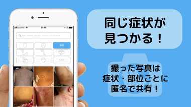 悩みや治療過程の画像を共有…“アトピー患者”のための専用アプリを作ったのは公認会計士