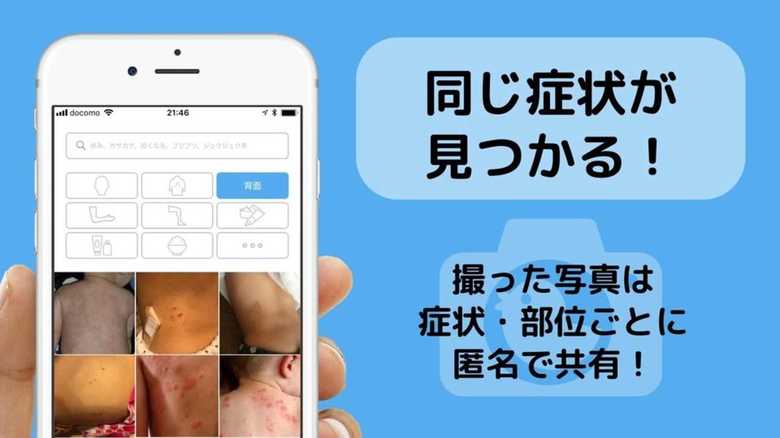 悩みや治療過程の画像を共有…“アトピー患者”のための専用アプリを作ったのは公認会計士