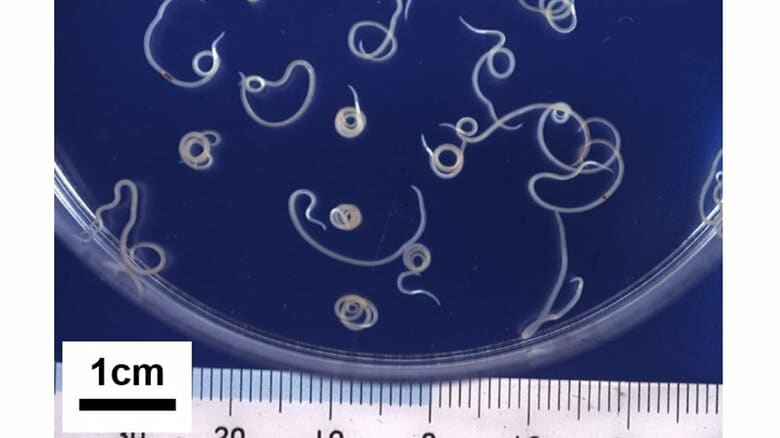 アニサキスの幼虫（画像提供：国立感染症研究所）