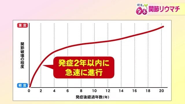 関節の破壊は発症後2年以内に進行