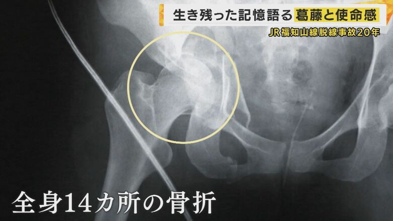 事故直後の浅野さんのレントゲン写真