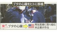 世界初「ブタの心臓をヒトに移植」手術後も“順調”…なぜブタ?拒絶反応はどう防ぐ?移植の背景を解説