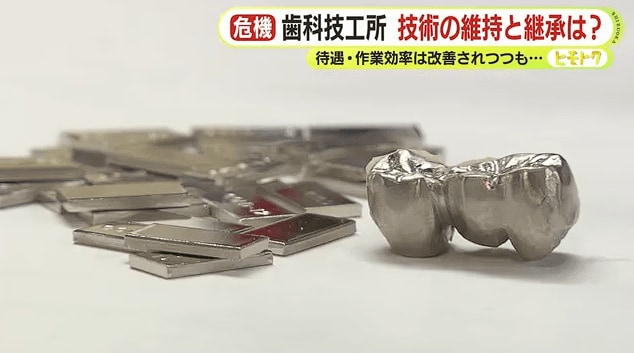銀歯の材料となるパラジウム