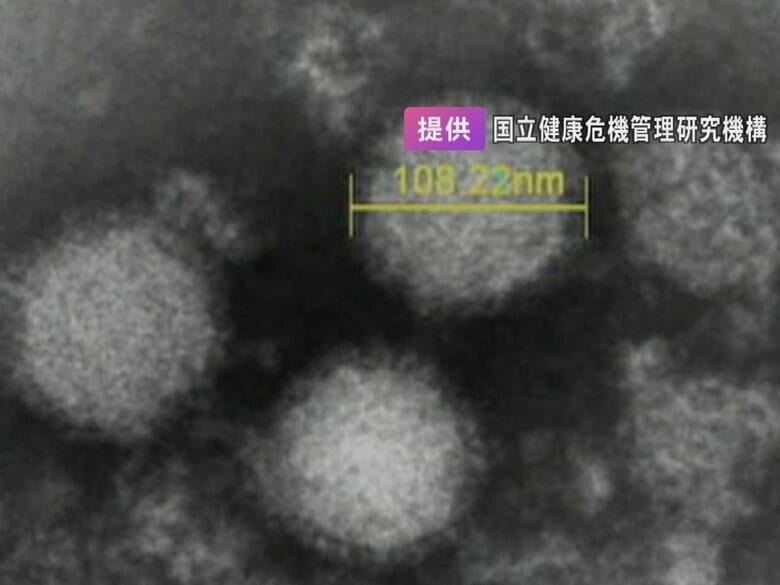 マダニによる感染症の疑いがある猫を治療した獣医師が死亡 呼吸困難等の症状訴え同じウイルスへの感染が判明｜FNNプライムオンライン