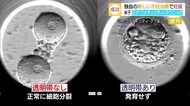 出産すれば世界初 これまで妊娠しなかった夫婦が妊娠 新たな不妊治療【鳥取】