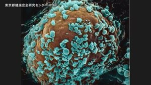 沖縄県 新たに125人の新型コロナウイルスへの感染確認