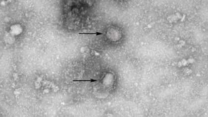 新型コロナ 全国の重症者数は481人