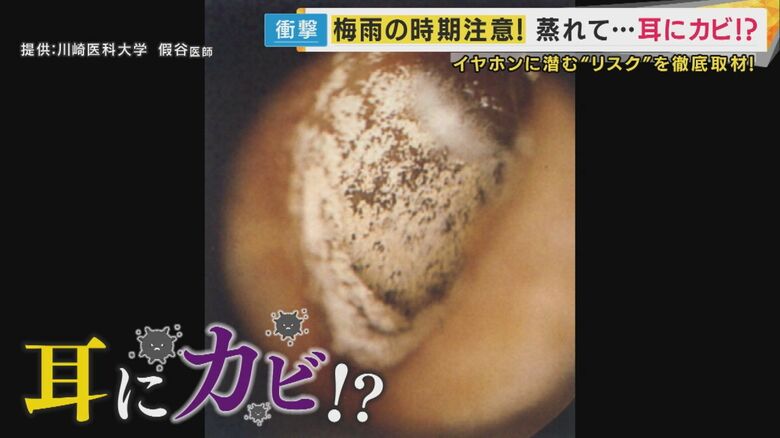 【専門医が警告】梅雨の危険！「耳の中にカビ」が生える恐怖 難聴から認知症リスクまで｜FNNプライムオンライン