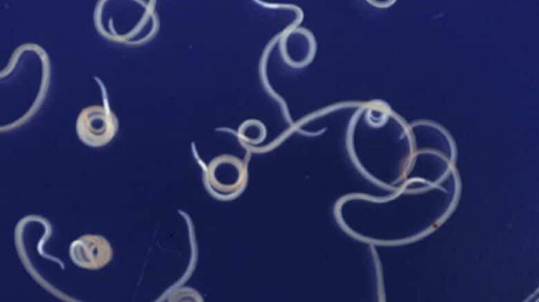 アニサキス（出典：国立健康危機管理研究機構 感染症情報提供サイト）