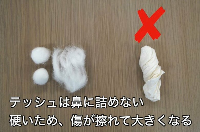 ティッシュは鼻に詰めない（提供：一般社団法人 日本耳鼻咽喉科頭頸部外科学会）