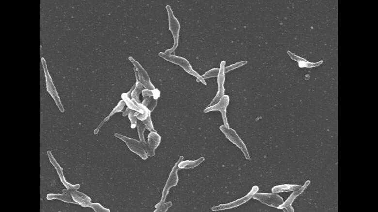 国立感染症研究所