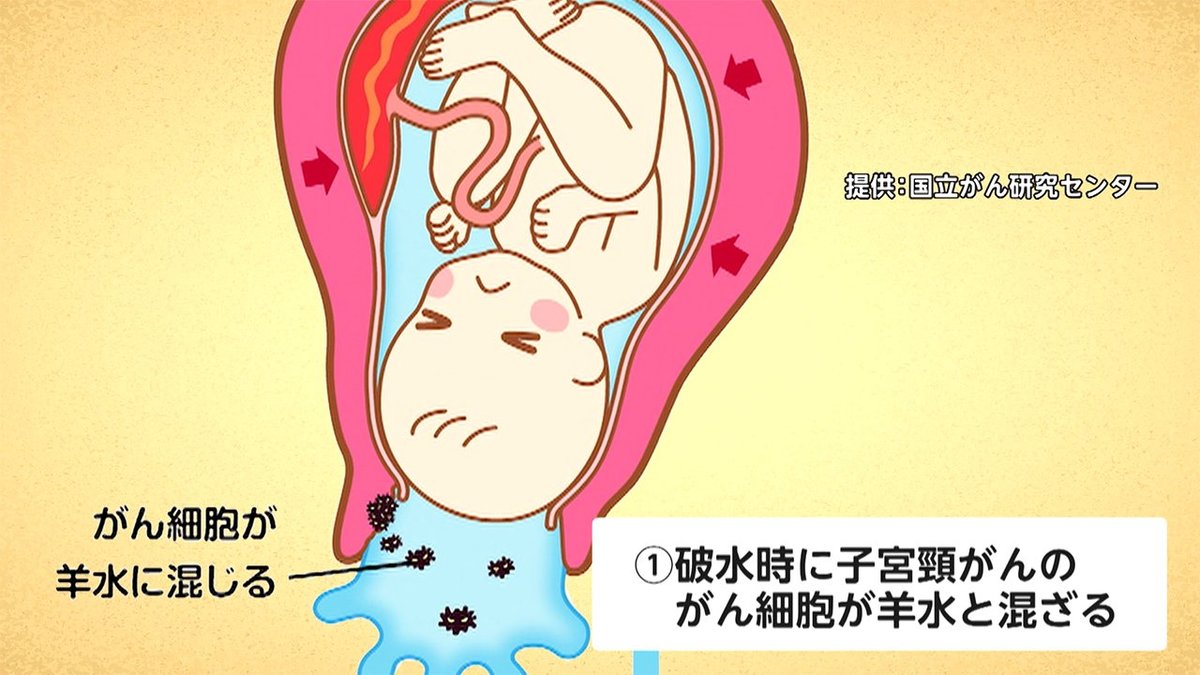 感じ 破水 どんな