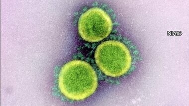 【速報】新型コロナ 全国の重症者は413人 前日より23人減る