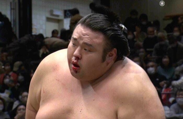 初場所で流血を伴う激しい相撲を見せた貴景勝