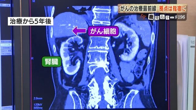 治療から5年後