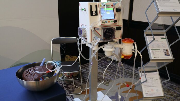 臓器内にポンプなどで保存液を循環させる肝臓のマシン・パーフュージョン装置（日本移植学会にて撮影）