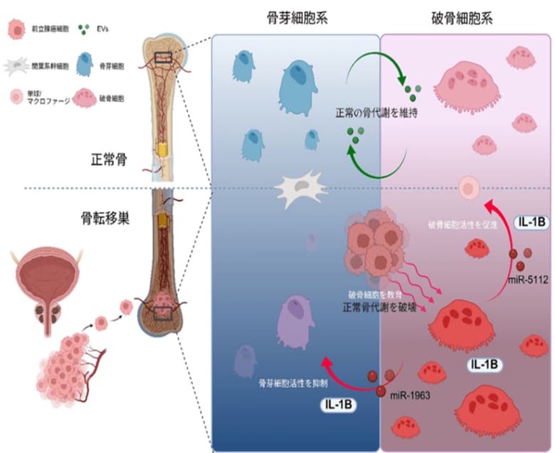 前立腺がんの骨転移を悪化させる仕組みを解明 ~破骨細胞からの“メッセージ”が鍵に~