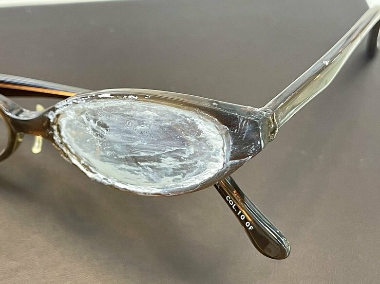 接着剤が付着したメガネ　接着剤が白くなると修理できない（提供：坂田頼彦店主）