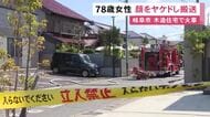 木造の集合住宅が燃える火事 1人暮らしの78歳女性が顔をやけど 隣接する2棟の屋根等にも延焼