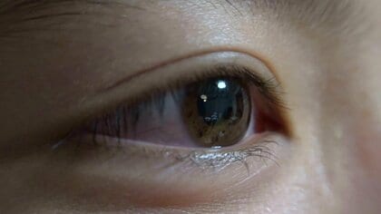 肌だけでなく“目の日焼け”もご用心 専門医｢恥ずかしがらずに帽子やサングラスを｣ 6月から紫外線増加【福井発】