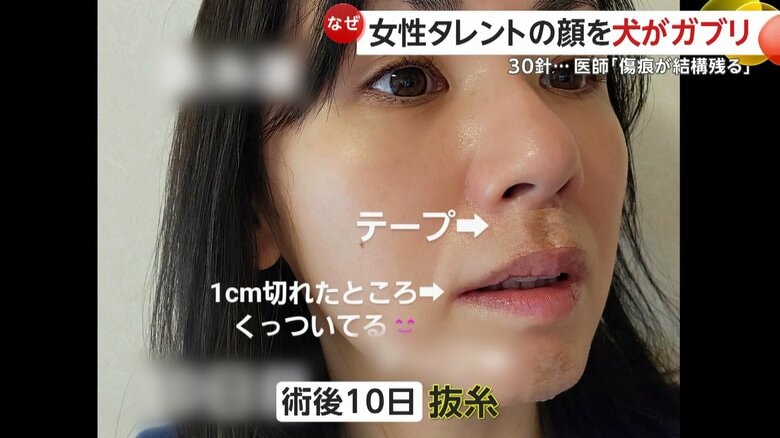 手術後10日で抜糸できたという