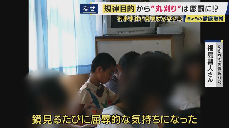 「鏡見るたびに屈辱的な気持ち」