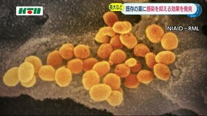 既存の薬に新型コロナ感染を抑える効果を発見 長崎大学などの研究チーム