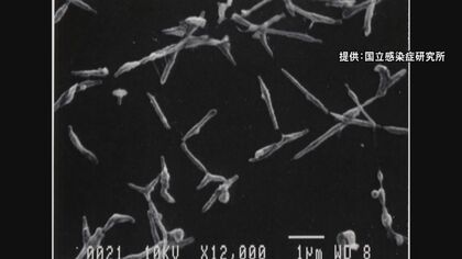 潜伏期間長く“歩く肺炎”とも…『マイコプラズマ肺炎』全国で患者数が6週連続増加 8年ぶり高水準に