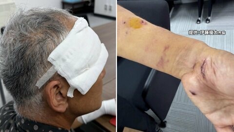 「子グマでも無事では済まない」クマが園芸店の男性襲撃　“襲われるまであっという間”被害男性が注意喚起　仙台市