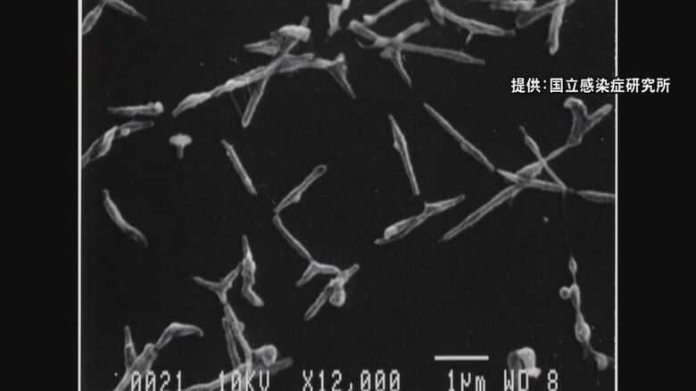 潜伏期間長く“歩く肺炎”とも…『マイコプラズマ肺炎』全国で患者数が6週連続増加 8年ぶり高水準に｜FNNプライムオンライン