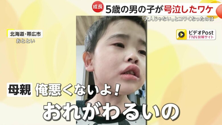 歯が抜けることで自分を責める男の子