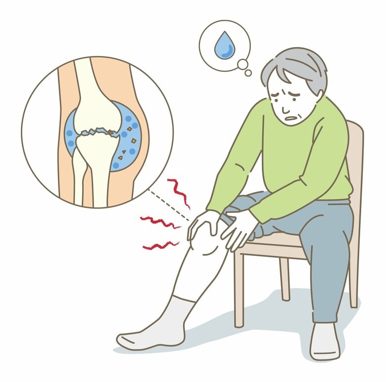 （画像はイメージ）