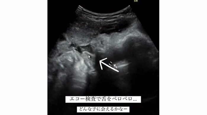 舌部分にカーソルを当て、先生が説明したという