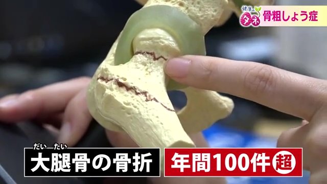 最も深刻なのが大腿骨の骨折