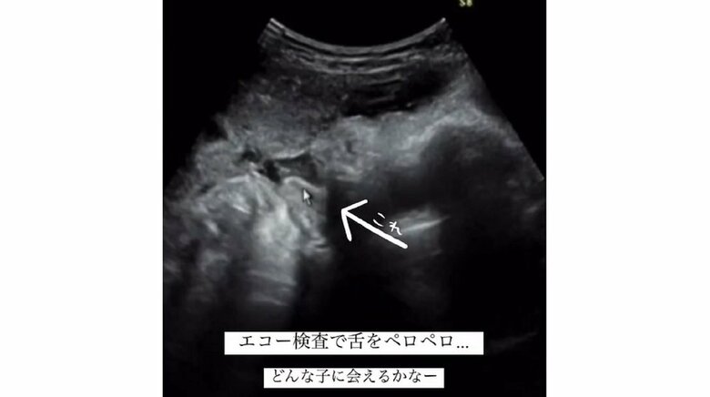 舌部分にカーソルを当て、先生が説明したという