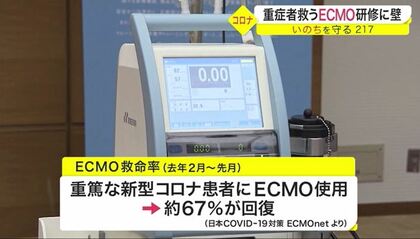 新型コロナ重症者救う！人工心肺装置「ECMO」最新医療が進まぬ壁