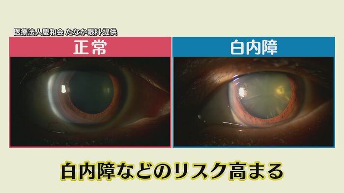 医療法人慶和会たなか眼科提供