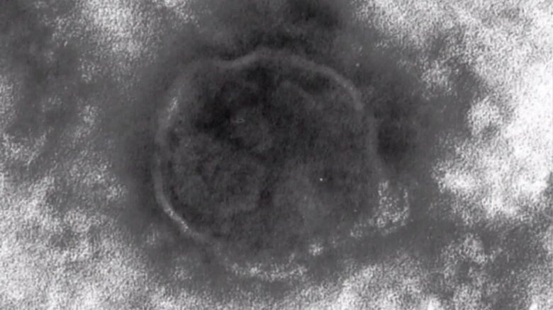 はしかウイルス（提供：東京都健康安全研究センター）