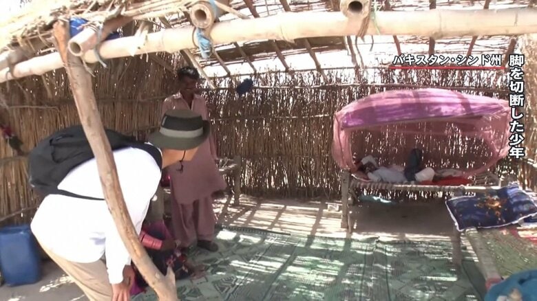 脚の膝から下を切断した少年