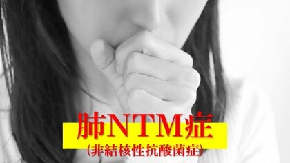 【危険】3カ月以上長引くせき「肺NTM症」が増加傾向　日常に潜む菌で感染…死亡者数は結核の1.5倍　中高年・女性・痩せ型の人は特に注意